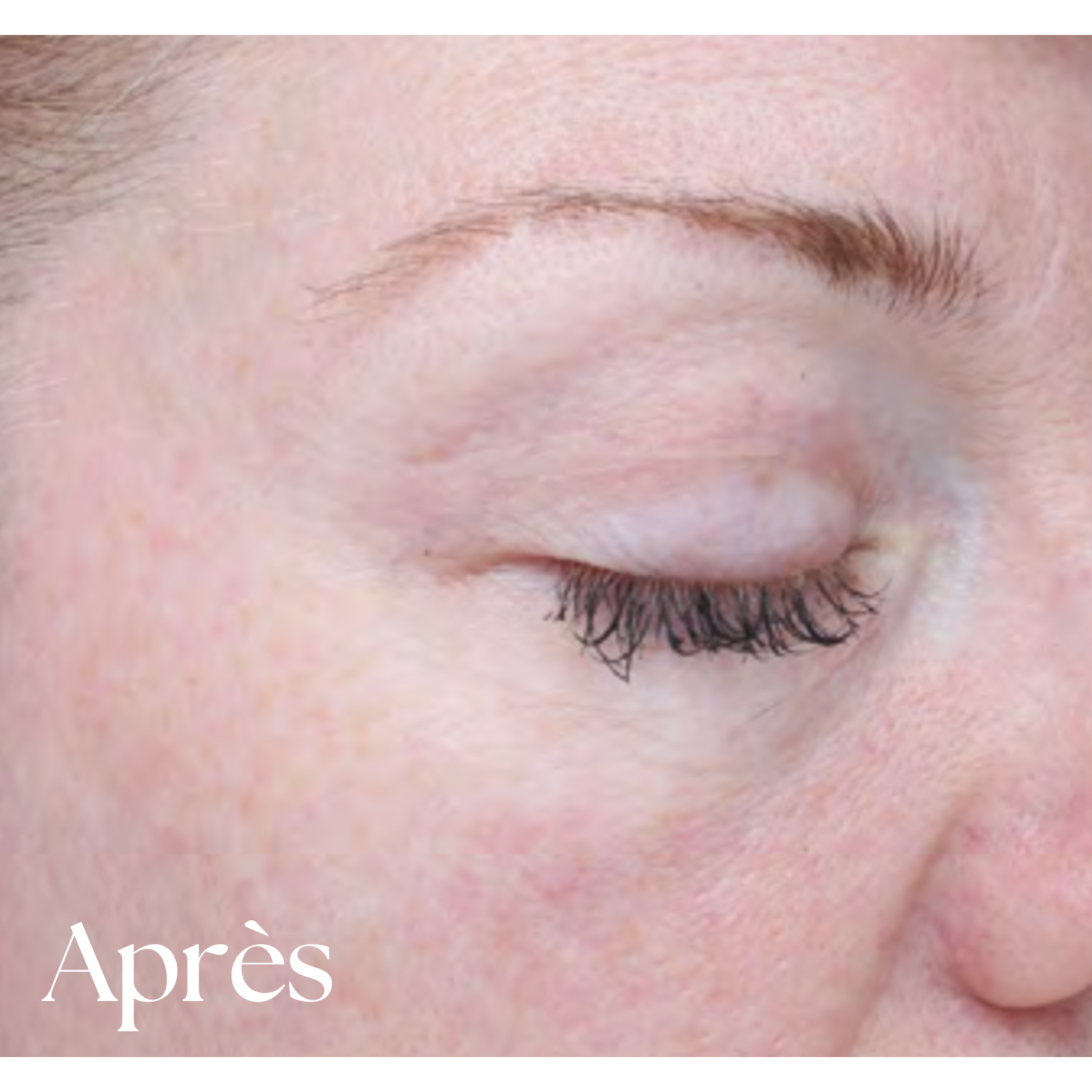 Sérum EGF Intense Bioeffect