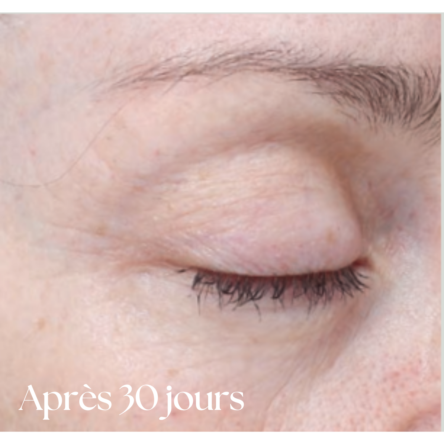 Traitement 30 jours Bioeffect