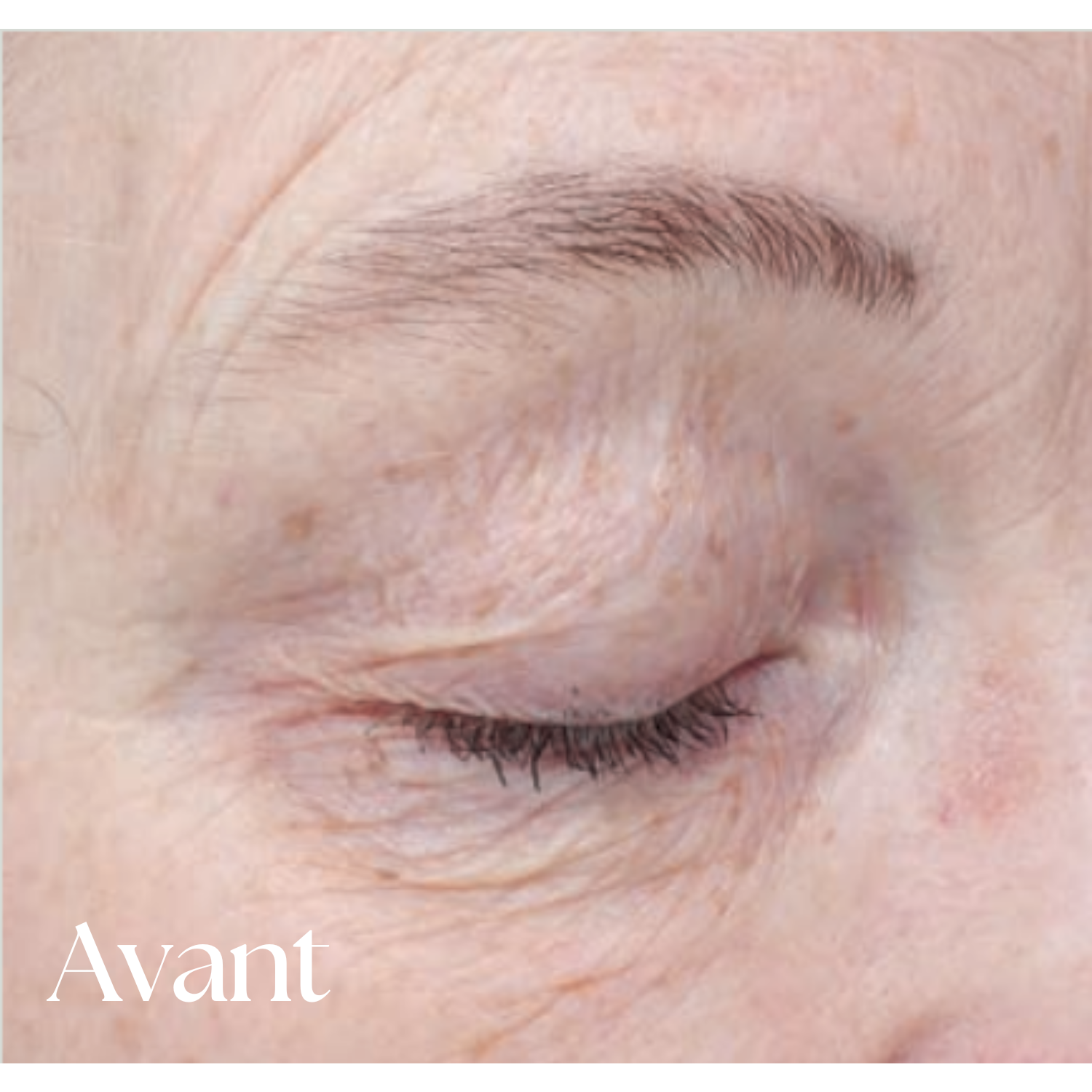 Crème Yeux POWER EGF Bioeffect