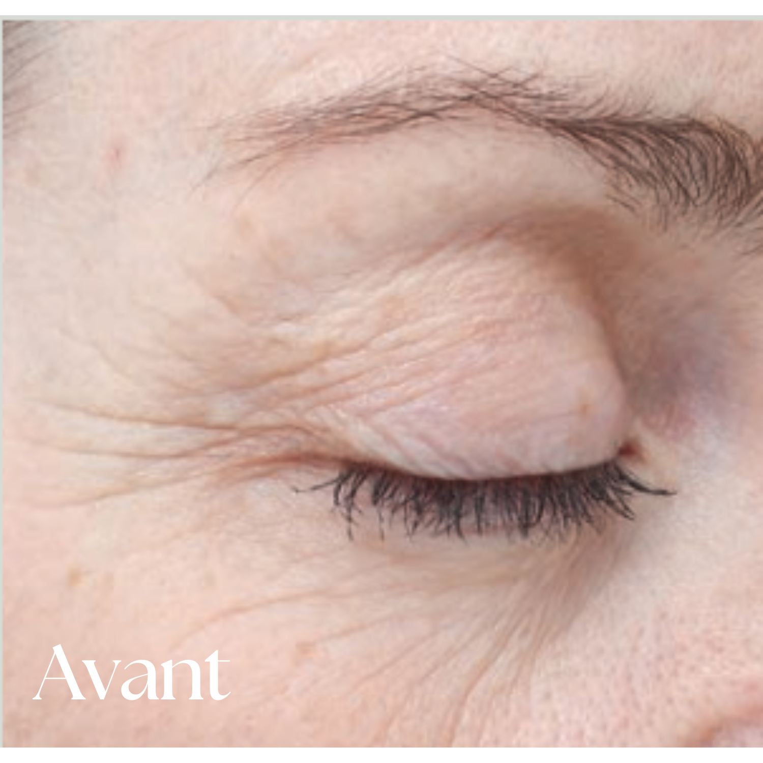 Traitement 30 jours Bioeffect
