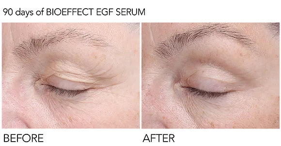 Sérum EGF Bioeffect