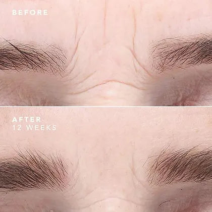 Kit Maison - Soin visage BIOEFFECT