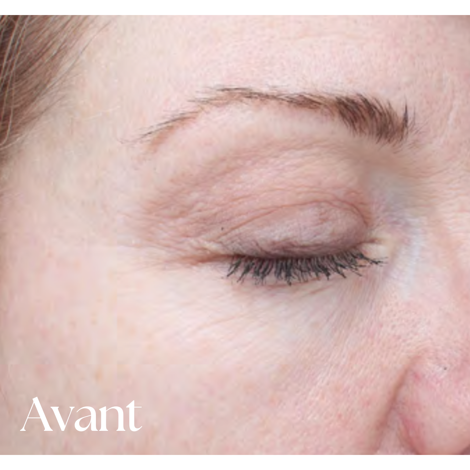 Sérum EGF Intense Bioeffect